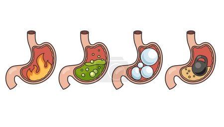 Illustration for Stomach disease. Heaviness in the stomach, bloating, increased acidity in the stomach, burning in the stomach hand drawn schematic vector illustration. Medical science educational illustration - Royalty Free Image