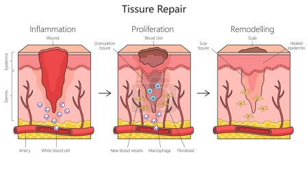 Illustration for Tissue repair structure diagram hand drawn schematic vector illustration. Medical science educational illustration - Royalty Free Image