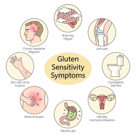síntomas de sensibilidad al gluten, incluyendo migrañas, dolor en las articulaciones y erupciones en la piel diagrama dibujado a mano ilustración vectorial esquemática. Ilustración educativa de ciencias médicas