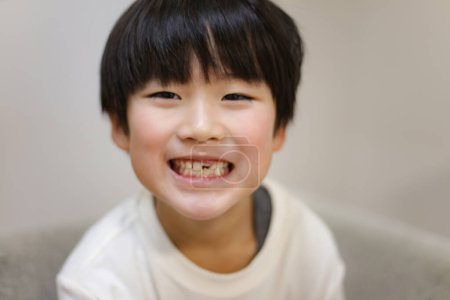 Photo pour Boy with missing front teeth - image libre de droit