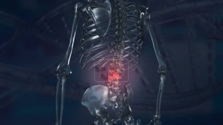 El dolor de espalda, también conocido como dolor de espalda, es una dolencia común que afecta a muchas personas en algún momento de sus vidas. Puede variar desde un dolor sordo y constante hasta un repentino
