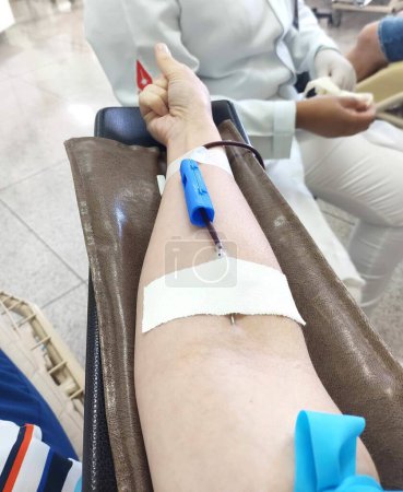 Der Arm einer weißen Person mit einer Nadel, die während der Blutspende als freiwilliger Helfer in der humanitären Hilfe sanft die Haut durchbohrt. Ein einfacher Akt der Großzügigkeit, der Leben rettet.