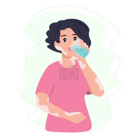Illustration for Woman with vitiligo disease drinking a fresh glass of water. Healthy and Sustainable Lifestyle Concept - Royalty Free Image
