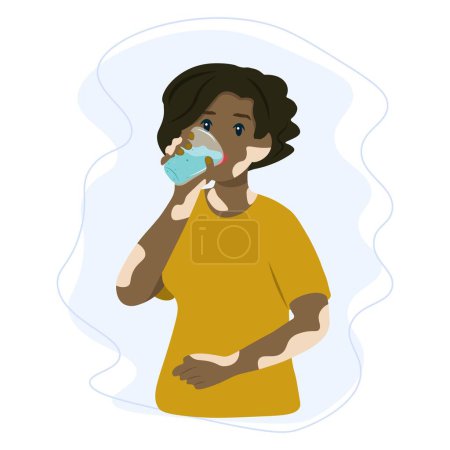 Illustration for Woman with vitiligo disease drinking a fresh glass of water. Healthy and Sustainable Lifestyle Concept - Royalty Free Image