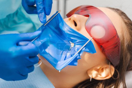 Close up shot of a female patient at the dentist wearing latex dental dam and protection glasses.