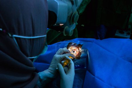 Foto de BOGOR, INDONESIA - 27 de marzo de 2023: Los médicos realizan una cirugía ocular de catarata en pacientes que utilizan la técnica de facoemulsificación en la clínica ocular, distrito de Bogor Regency, Indonesia, el 27 de marzo de 2023 - Imagen libre de derechos