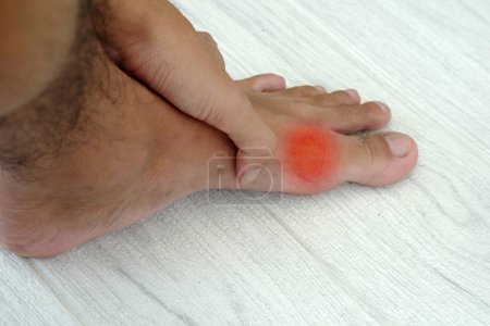 Human hand holding a sore leg, joint pain, gout, leg pain, soreness and injury.