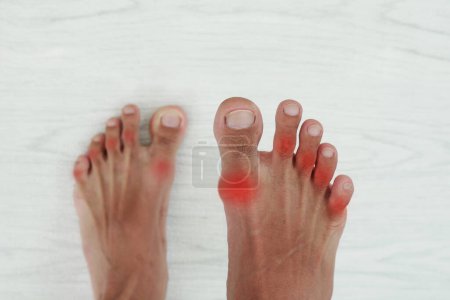 foot pain. joint pain, gout, leg pain, soreness and injury.