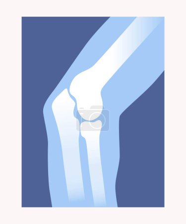 Illustration for Xray scan concept. Medical anatomical poster with elbow, shoulder and forearm bones. Design element for infographics. Human skeleton. Cartoon modern flat vector illustration on white background - Royalty Free Image