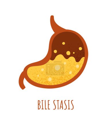 Illustration for Bile stasis stomach concept. Pain and illness, suffering. Digestive tract, gastro abdomen organ and gastroenterology. Poster or banner for website. Cartoon flat vector illustration - Royalty Free Image
