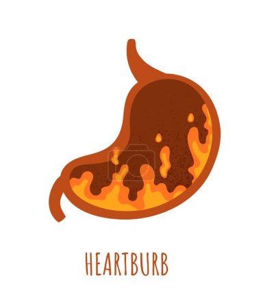 Ilustración de Concepto de estómago Heartburb. Órgano humano interno en llamas. Indigestión y comida picante. Gastroenterología y salud. Plantilla, diseño y maqueta. Dibujos animados ilustración vector plano - Imagen libre de derechos