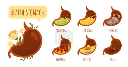 Illustration for Sick stomach set. Collection of digestive disorders, medical infographics. Stages of food digestion. Poisoning, bloating and heartburb. Cartoon flat vector illustrations isolated on white background - Royalty Free Image