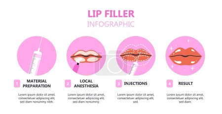 Illustration for Lip filler infographic. Data visualization and tutorials. Botox injections and facelifting, plastic surgery. Beauty, elegance and aesthetics. Flat vector illustration isolated on white background - Royalty Free Image