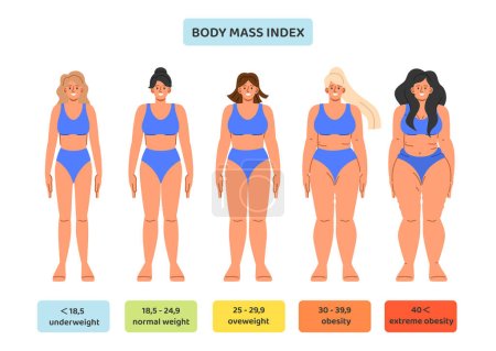 Illustration for Set of body mass index concept. Medical infographics and educational materials. Underweight, overweight, obesity and normal weight. Cartoon flat vector collection isolated on white background - Royalty Free Image