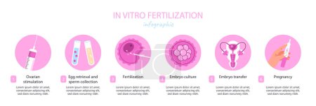 Illustration for IVF infographic concept. Fertilization and ovulation. Reproductive system and health care. Gynecology, anatomy and biology. Cartoon flat vector illustration isolated on white background - Royalty Free Image