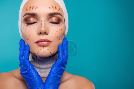 Foto de Photo of lady with drawing correction marks on face touch by doctor prepare for beauty operation over cyan background. - Imagen libre de derechos