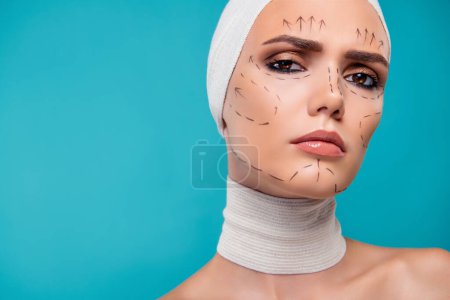Téléchargez les photos : Photo d'une jolie fille patiente en bandage médical avec des marques de correction faciale sur fond de cyan. - en image libre de droit