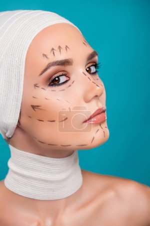 Foto de Foto de atractiva dama en vendaje médico tiene marcas de corrección facial para cirugía plástica sobre fondo cian. - Imagen libre de derechos