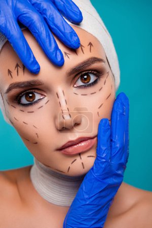 Photo for Close up photo of lady touch face by doctor hands prepare for beauty operation isolated over cyan background. - Royalty Free Image