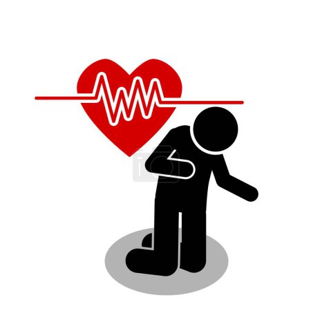 Ilustración de Pictograma y figura de palo vector ilustración de un hombre que tiene un ataque al corazón, enfermedades del corazón - Imagen libre de derechos