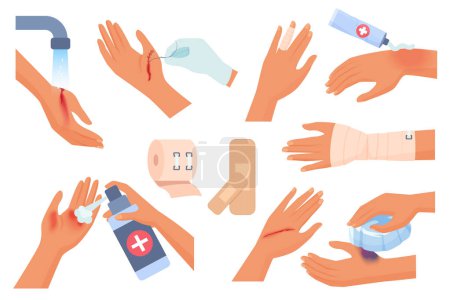 Illustration for First aid for hand injury set vector illustration. Cartoon isolated injured human arms of patient with wound and burn on skin, hands cleaning trauma with water, using elastic bandage and dressings - Royalty Free Image