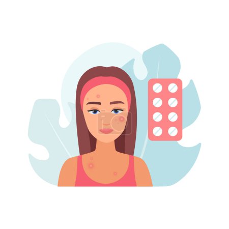 Illustration for Medical treatment of acne, young woman with pimples on face and blister of pills vector illustration - Royalty Free Image