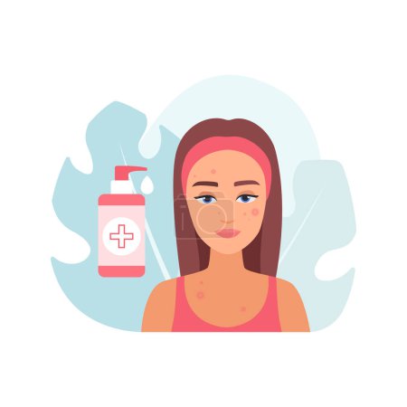Illustration for Cosmetic skincare and cleansing for skin with acne, young woman with pimply face and bottle of gel vector illustration - Royalty Free Image