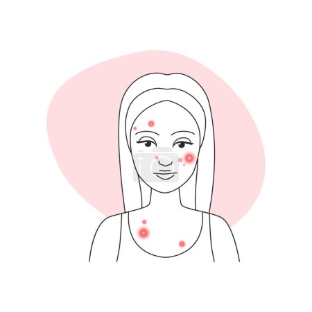 Illustration for Sad young woman with pimply skin on face before acne treatment vector illustration - Royalty Free Image