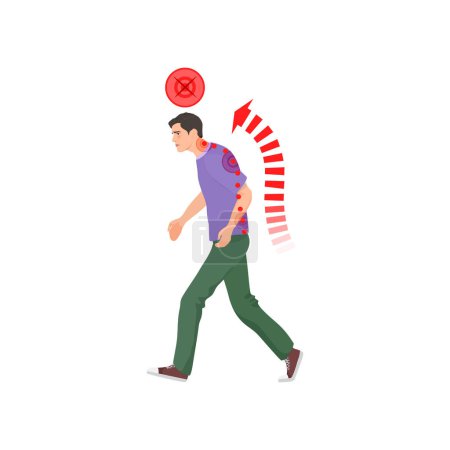 Illustration for Walking man in wrong spine posture. Spine problems, bad walking pose cartoon vector illustration - Royalty Free Image