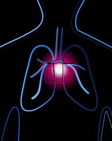 Ilustración de Ilustración aislada vectorial de pulmones humanos. Enfermedades pulmonares. Esquema de dibujo de los pulmones humanos. Tuberculosis. - Imagen libre de derechos