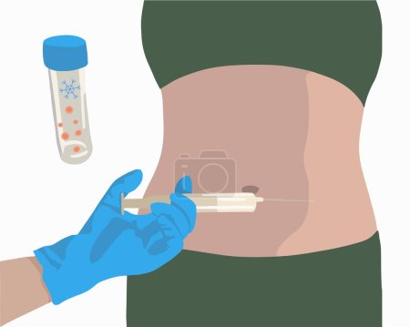 Illustration for Vector isolated illustration of ovulation stimulation process. Egg donation. Ovary stimulation. Egg freezing. Artificial insemination. - Royalty Free Image