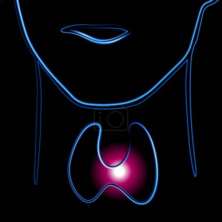 Illustration for Vector isolated illustration of thyroid gland with neon effect. Enlarged thyroid gland. - Royalty Free Image