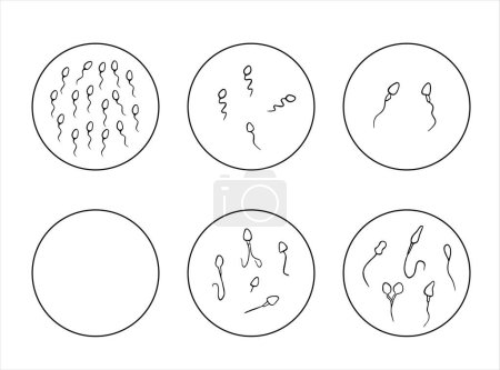 Illustration vectorielle isolée des pathologies du sperme. Spermogramme. Défauts de sperme. Défauts de la tête du sperme. Motilité du sperme.
