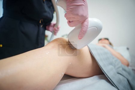 Primer plano de un tratamiento de depilación láser o rejuvenecimiento de la piel en una pierna de un cliente por un profesional con guantes en un ambiente de salón limpio, con un enfoque en la acción y el cuidado.