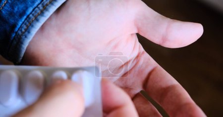Photo for A man strains to extract a peach-colored pill into his palm. Close-up shot emphasizes health and medication. Suitable for medical-themed videos. - Royalty Free Image
