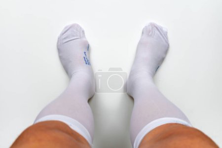 Téléchargez les photos : Une personne portant une paire de bas de compression après la chirurgie pour prévenir les caillots sanguins et la thrombose veineuse profonde. - en image libre de droit