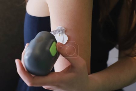 Foto de Sensor de glucosa en sangre justo después de la inserción con el dispositivo de inserción - Imagen libre de derechos