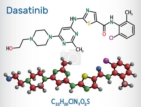 Illustration for Dasatinib molecule. It is used to treat of myelogenous leukemia, CML, and acute lymphoblastic leukemia, ALL. Structural chemical formula, molecule model. Vector illustration - Royalty Free Image