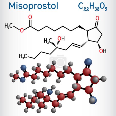 Illustration for Misoprostol molecule. It is prostaglandin E1 analogue, used to treat stomach, duodenal ulcers, induce labor, cause an abortion. Structural chemical formula and molecule model. Vector illustration - Royalty Free Image