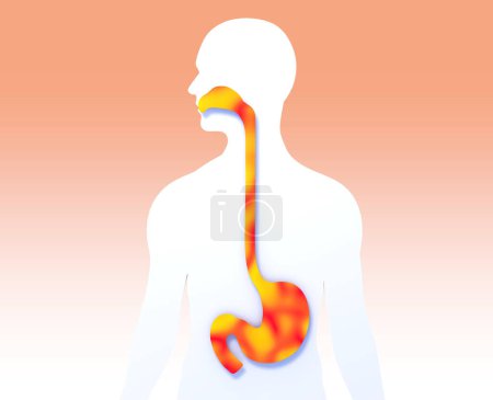 Illustration 3D de l'estomac et de l'?sophage à la bouche avec feu. Montrant le système digestif anatomique sur découpe silhouette humaine sur fond blanc.