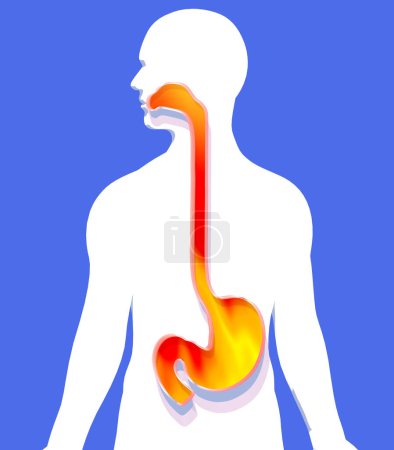 Illustration 3D de l'estomac et de l'?sophage à la bouche avec feu et indigestion. Affichage du système digestif sur découpe silhouette humaine sur fond bleu.