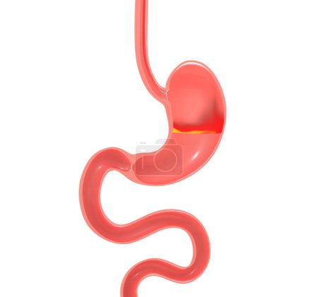 Anatomical 3D illustration of stomach with heartburn and reflux. With fire and moving flames inside. Cut out on white background.