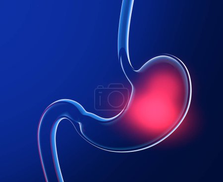 3D illustration of stomach with burning. Anatomical cut of transparent glass with lights and reflections on a dark blue background.
