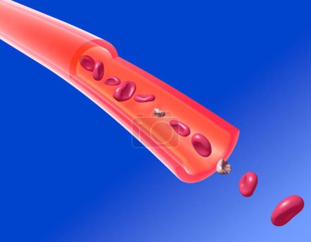 Anatomische 3D-Illustration einer inkompetenten Arterie. Bewegung roter Blutkörperchen und Blutplättchen bei schlechter Durchblutung. Ausschnittkapillare auf blauem Hintergrund.