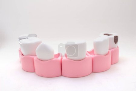 Photo for The model teeth, model teeth displaying different - Royalty Free Image