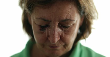 Foto de Mujer mayor sacudiendo la cabeza con desaprobación, retrato de mujer con puntadas y cicatriz - Imagen libre de derechos