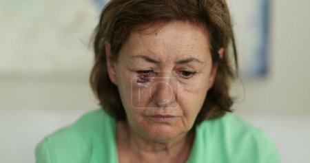 Téléchargez les photos : Femme âgée meurtrie avec cicatrice regardant à la caméra avec une émotion triste - en image libre de droit