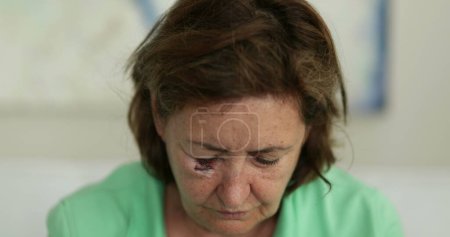 Foto de Mujer mayor con cara y moretones en la cara mirando hacia abajo, emoción triste - Imagen libre de derechos