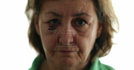 Téléchargez les photos : Femme plus âgée secouant la tête avec désapprobation, portrait de femme avec des points de suture et cicatrice - en image libre de droit