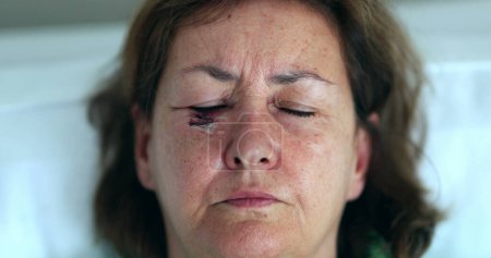 Téléchargez les photos : Femme plus âgée avec cicatrice ecchymose visage ouvrant les yeux regardant à la caméra - en image libre de droit